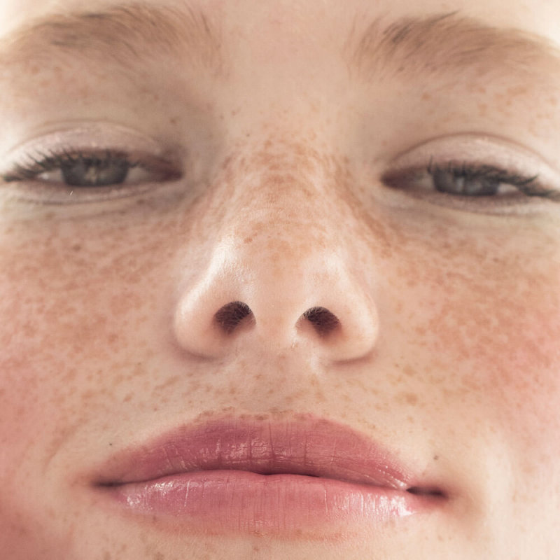 Freckled and Beautiful